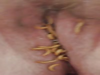 Mealworms in pussy