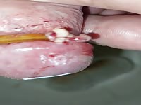 Bizarre cbt insertion bdsm pervers insect
